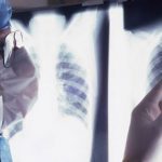 prevenzione e screening