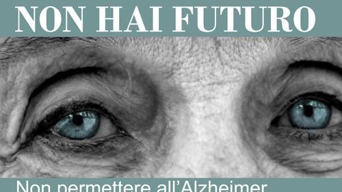 progetto alzheimer