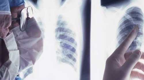 prevenzione e screening